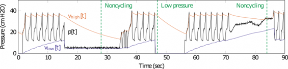 Diagram of pressure changes over time for noncycling and low pressure patterns.